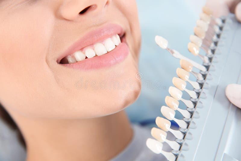 Dentist selecting patient`s teeth color with palette in clinic, closeup. Dentist selecting patient`s teeth color with palette in clinic, closeup